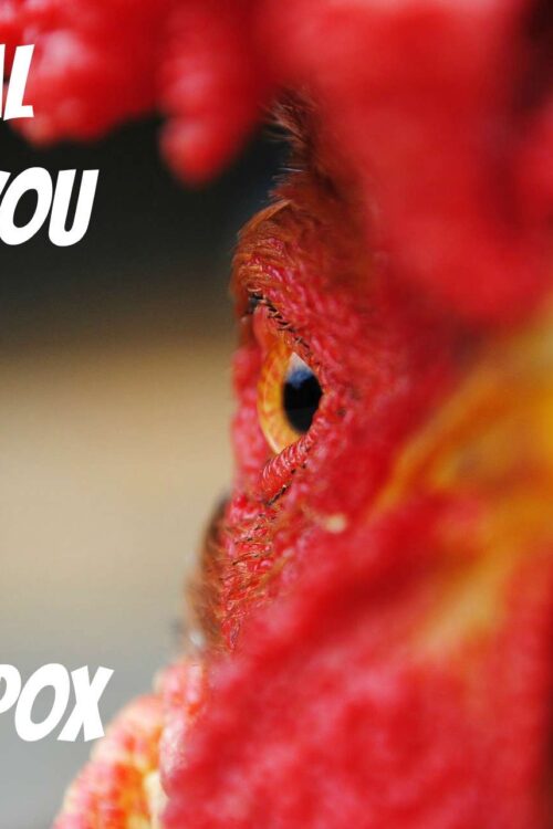 9 Crucial Things You Need To Know About Chickenpox