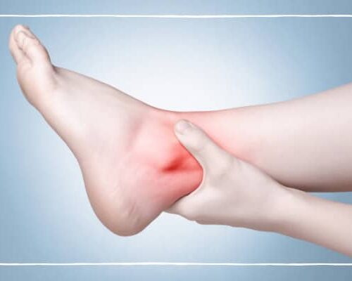 5 Steps to Take to Recover From an Athletic Injury at Home 