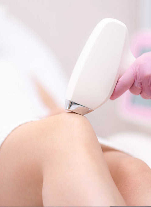 What is the Difference Between Laser Hair Removal and Sugaring or Epilation