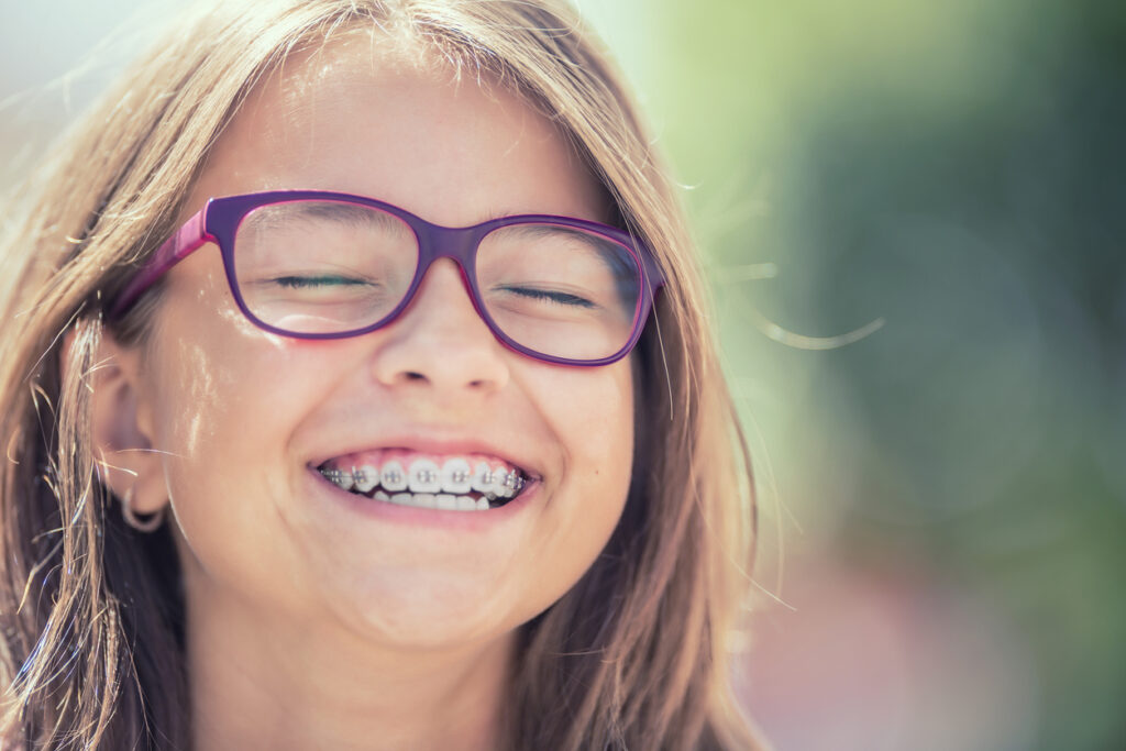 straightening your smile