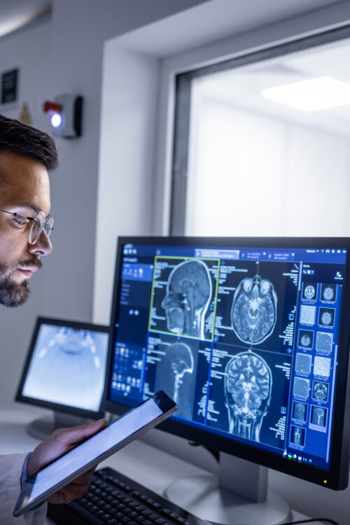 4 Surprising Things an MRI of the Brain Can Reveal 